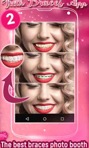 Teeth Braces App 2 2