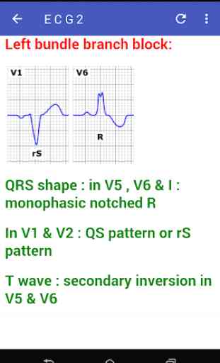 Learn How To Read ECG 3