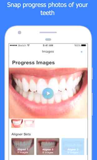 Smart Smile App 4