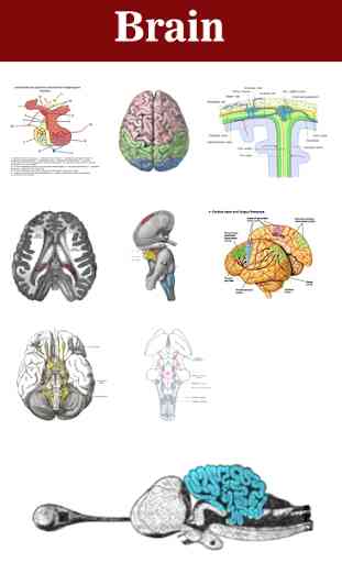Cervello 3