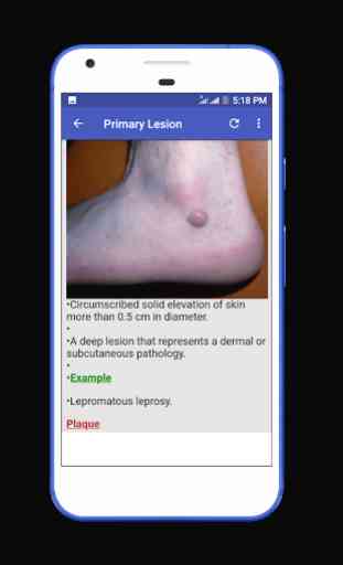 Dermatology Atlas & Skin Infections 4