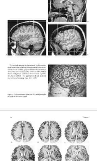 MRI - Regional Anatomy of the Brain Using MRI 4
