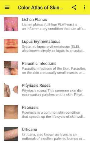 Color Atlas of Skin Diseases - Dermatology Atlas 2