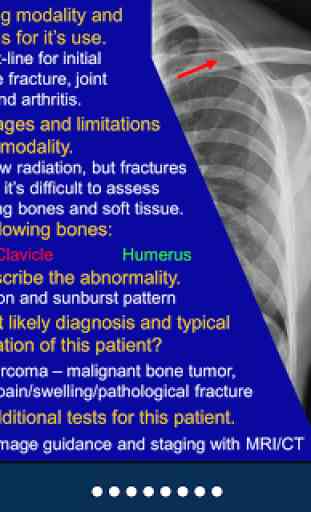 Basic Radiology - SecondLook 2