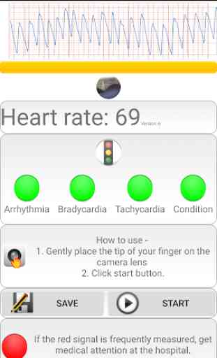 Diagnosi cardiaca (frequenza cardiaca, aritmia) 3