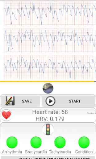 Diagnosi cardiaca (frequenza cardiaca, aritmia) 4