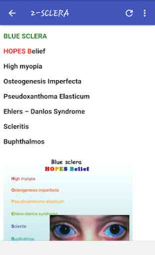 Ophthalmology Mnemonics 4