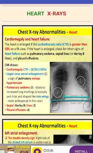 All Lung Sounds & Chest X-Rays 3