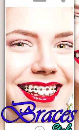 braces camera & braces Teeth photo editor 3