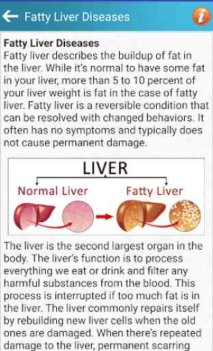 Fatty Liver Diet Healthy Foods & Hepatic Steatosis 2