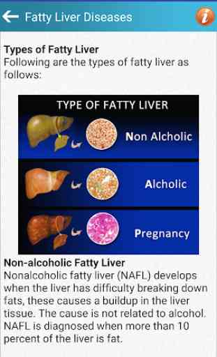 Fatty Liver Diet Healthy Foods & Hepatic Steatosis 3