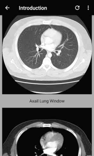 Guide to Interpretation of CT chest 3