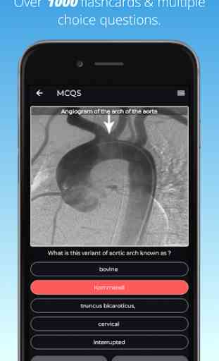 FRCR Radiological Anatomy Flashcards & MCQs 2