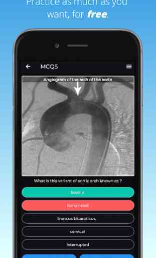 FRCR Radiological Anatomy Flashcards & MCQs 3