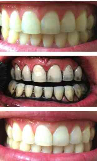 teeth whitening naturally tips 1