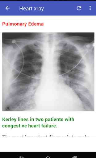 Cardiac X-rays 2