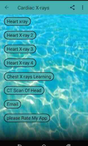 Cardiac X-rays 4