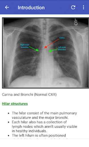 Chest X-Ray Based Cases 1