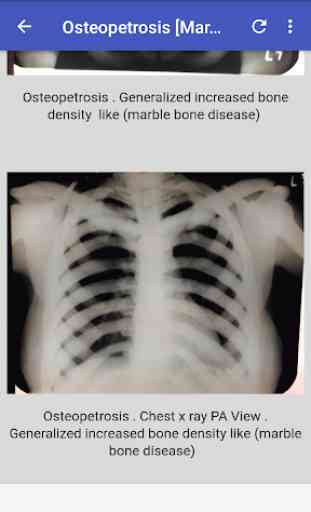 Musculoskeletal X- Rays Interpretation 3