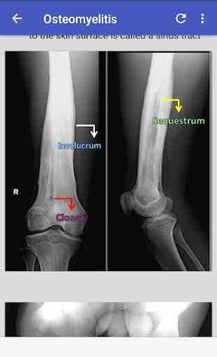 Musculoskeletal X- Rays Interpretation 4