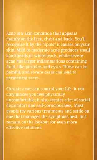acne removal tips natural 3