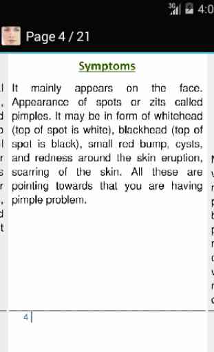How to Get Rid of Pimples 3