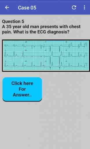 ECG Cases 3