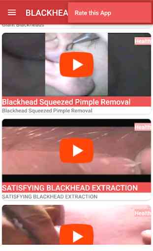 BLACKHEADS VIDEOS 2017 2