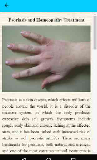 Natural Treatments For Psoriasis 4