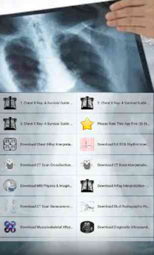 Chest X Ray - A Survival Guide 1
