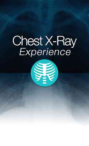 Chest X-Ray Experience 1
