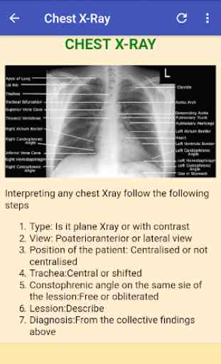 X Ray Chest Urinary Bone & GIT 4