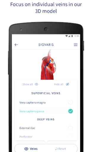 SIGVARIS GROUP Vein App 2