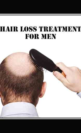 Hair loss Treatment for men 1