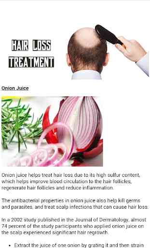 Hair loss Treatment for men 3
