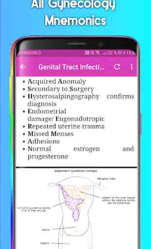 Obstetrics & Gynecology Mnemonics 2