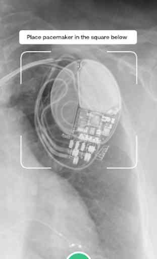 Pacemaker ID - Pacemakers and Defibrillators 1