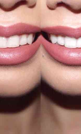 Teeth Whitening Tips 1