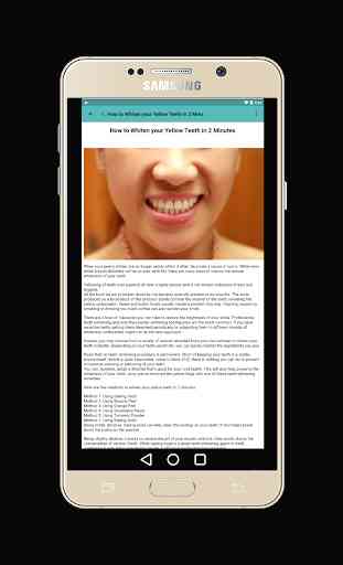 Teeth Whitening Tips: How to Remove Teeth Stains 4
