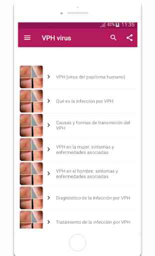 VPH virus síntomas tratamiento y prevención 1
