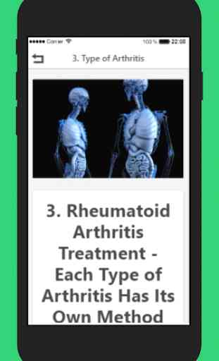 Rheumatoid Arthritis Treatment 4
