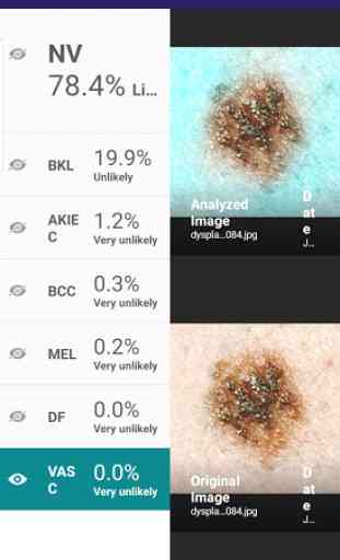 Visus: Skin Cancer Detection 4