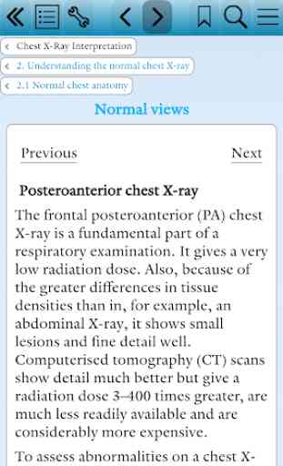 Pocket Tutor: Chest X-Ray Interpretation 2