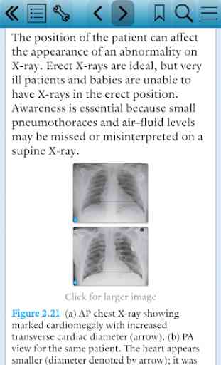 Pocket Tutor: Chest X-Ray Interpretation 3