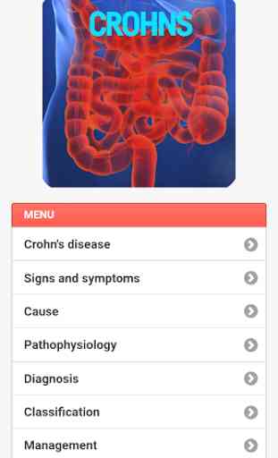 Crohns Disease 2