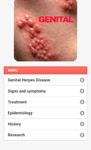 Genital Herpes 2
