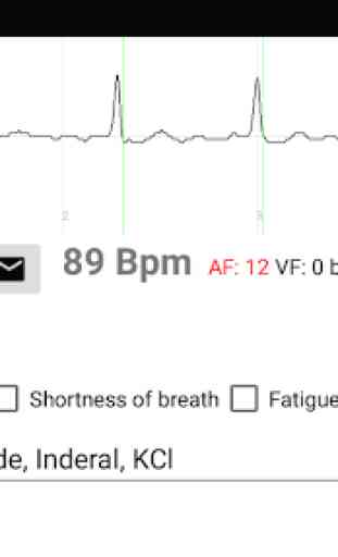 Heart Inform Electrocardiogram Recorder 1