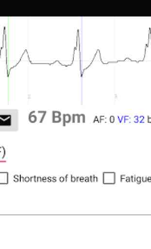 Heart Inform Electrocardiogram Recorder 2