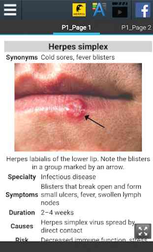Herpes Info 2