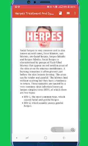 Herpes Treatment And Symptoms 4